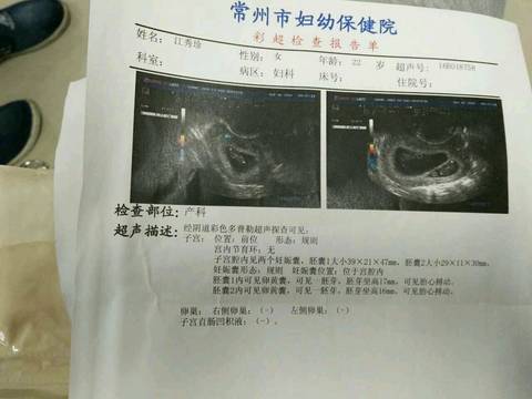 孕两个月B超，探索早期妊娠的神奇之旅