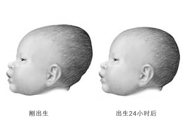 九个月宝宝的囟门发育，关注大囟门背后的健康信息